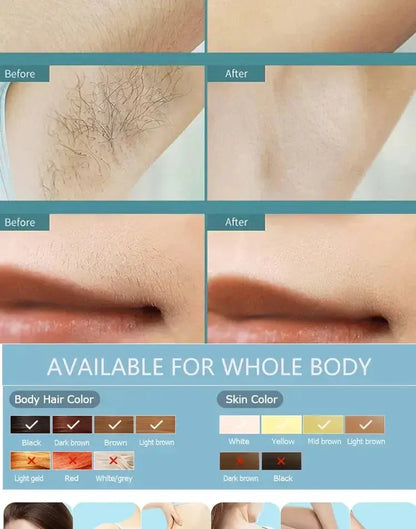 IPL Laser Hair Remover Intense Pulsed Light 500000 Pulses Permanent Laser Hair Remover Women's Painless Hair Removal Home Device - ALPENZO